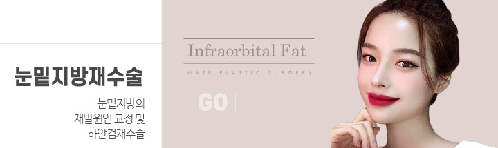 눈밑지방재수술