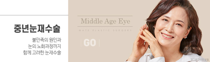 중년눈재수술